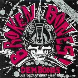 Broken Bones : Dem Bones Decapitated